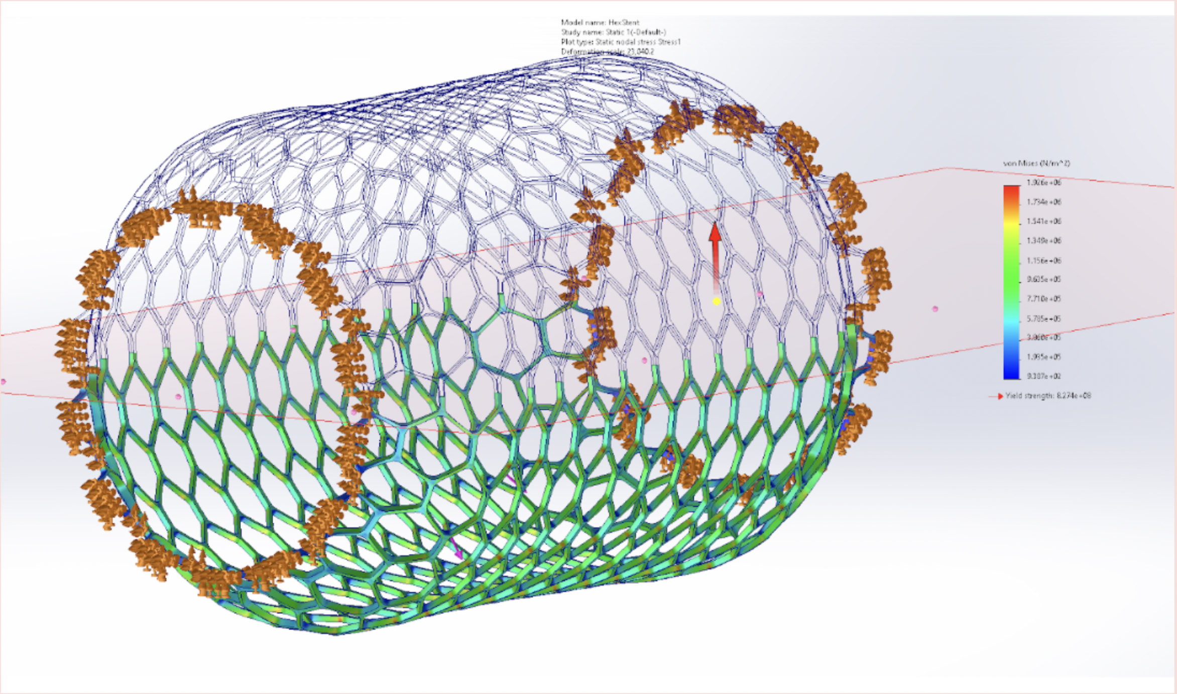 Coronary Stent FEA Analysis